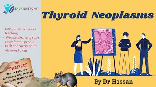 Thyroid Neoplasms Pathology  Mnemonics  Papillary Carcinoma  Endocrinology  Crack NEET PG USMLE [upl. by Nolan844]