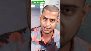 YouTuber Mehtab Saifi Hair Transplant  Before and After Surgery shorts viralvideo [upl. by Analim]