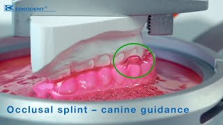 Occlusal splint – canine guidance [upl. by Woermer]