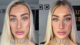 How to Contour a Crooked Nose Wow the difference [upl. by Noryak]