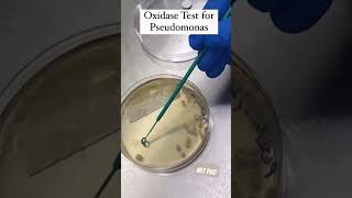 Oxidase Test for Pseudomonas  Microbiology test mbbs medical lab microbiology [upl. by Laufer422]