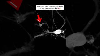 Brain cell restructures itself after forming a new connection neuroplasticity neuroscience brain [upl. by Lashoh]