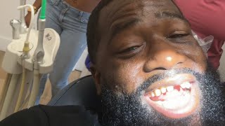 Adrien Broner shows us he lost a tooth in last fight vs Cobbs Esnews boxing [upl. by Adnopoz]