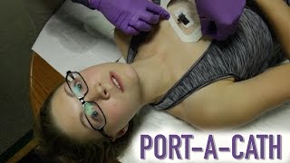 HOW TO ACCESS A PORTACATH IMPLANTED PORT [upl. by Thoer975]