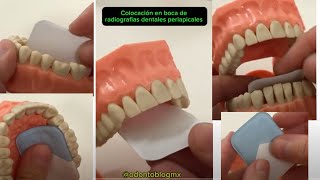 Colocación en boca de radiografías dentales periapicales para toma de radiografías [upl. by Ambros39]