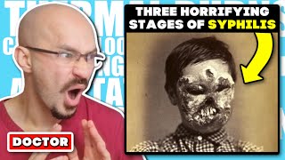 DOCTOR Reacts to The Three Horrifying Stages of Syphilis [upl. by Jo Ann]