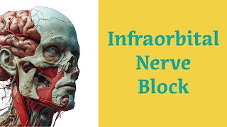 Infraorbital Nerve Block Procedure [upl. by Beitris]