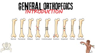 INTRO TO GENERAL ORTHOPEDICSCHP15FRACTURESTYPESAO classification orthopedics shamim dogar [upl. by Nadaha647]