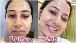 Dermatologist recommended Best 2 Cream under Rs 300 that has changed my skin  Best pharmacy cream [upl. by Rima]