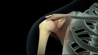 Rotator Cuff Shoulder Surgery [upl. by Dotti]