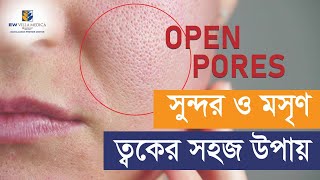 Treatments and Skin Care for Open Pores  Dr Tasnim Khan [upl. by Portuna]