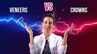 Veneers vs crowns  What is the difference [upl. by Robillard521]