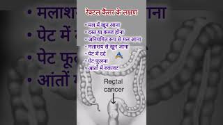 Rectal cancer symptomsरेक्टल कैंसर के लक्षणमलाशय के कैंसर के लक्षण [upl. by Ydnal466]