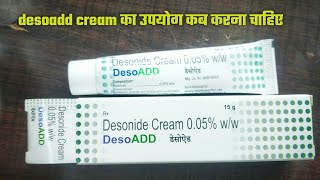 Desoadd Cream Full Review Effects and Side Effects Best for Psoriasis desoadd cream benefits deso [upl. by Oinotnanauj]