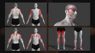 trigger point uitleg animatie Dutch [upl. by Hahcim]