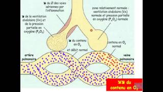 Semiologie de linsuffisance respiratoire Partie 1 [upl. by Desma]