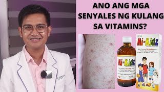 SENYALES NG MAY KAKULANGAN SA VITAMINS  BENEPISYO NG HI KIDZ [upl. by Gwynne469]