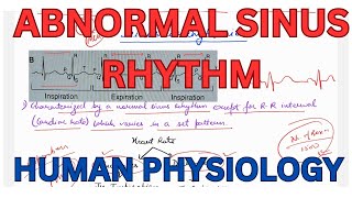 Abnormal sinus rhythm sinus arrhythmia sinus tachycardia sinus bradycardia [upl. by Taddeo]