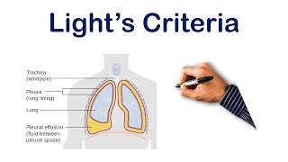 Pleural Effusion Lights Criteria  USMLE STEP COMLEX NCLEX [upl. by Dadinirt424]