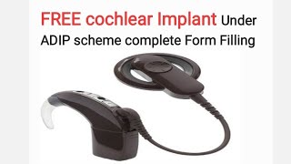 Free cochlear implant under Adip Scheme Form filling [upl. by Nerual43]