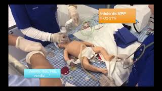 REANIMACION NEONATAL ALGORITMO COMPLETO [upl. by Avek236]