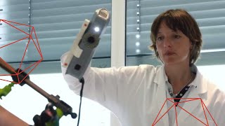 Using Artec 3D Scanners for Orthotics and Prosthetics [upl. by Refenej368]