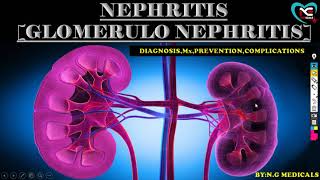 NEPHRITIS GLOMERULONEPHRITIS PART 2  FULL EXPLANATION IN HINDI BY NG MEDICALS [upl. by Satterfield]