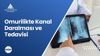 Omurilikte Kanal Daralması ve Tedavisi  Prof Dr Ahmet Hilmi Kaya [upl. by Siegfried]