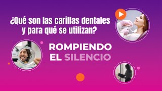 ¿QUÉ SON LAS CARILLAS DENTALES Y PARA QUÉ SE UTILIZAN [upl. by Mallorie]