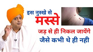 मस्से जड़ से ख़त्म करने के लिए How to Remove Warts Permanently  Sanyasi Ayurveda [upl. by Mureil443]