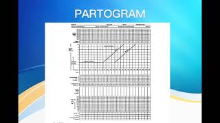 Partogram [upl. by Aerdnek]