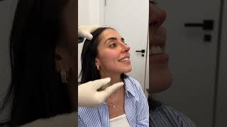 Rinoplastia Ultrasónica  Reacción de Cristina [upl. by Polik]