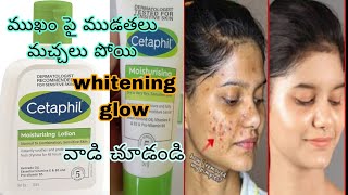 Dry amp Oily Skin  Best Cetaphil Skin Moisturizer  Whitening Glow Review  Skincare [upl. by Meece]