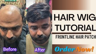 Hair Patch Kaise Lagta Hai  Hair Wigs  Hair Patch For Men Frontline Hair Patch [upl. by Nedry204]