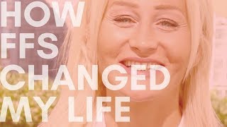 How FFS Changed My Life [upl. by Bundy]