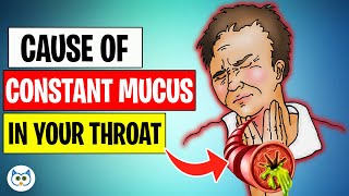 Top 7 Causes of Constant Mucus Phlegm In Your Throat [upl. by Isis]