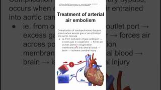 Treatment of arterial air embolism [upl. by Argella]