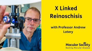 X Linked Retinoschisis with Professor Andrew Lotery [upl. by Augustine376]