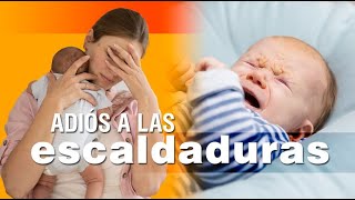 Las escaldaduras en los bebés  síntomas causas y soluciones [upl. by Perrins]