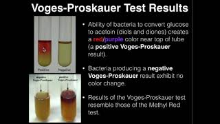 Microbiology VogesProskauer Test [upl. by Jael]