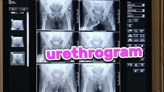 How i prepare urethrogram x ray  x ray urethrogram taking and filming [upl. by Love]