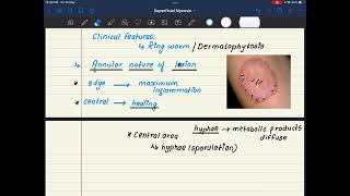 35🌟 Dermatophytosis Microbiology Medical Dose [upl. by Remmos]