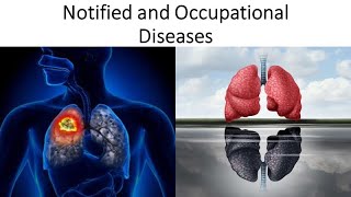 Notified and Occupational Diseases  Symptoms  Notice  Control amp Mitigation  Compensation [upl. by Patrich]