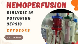 What is Hemoperfusion  Dialysis in Poisoning  Dialysis in sepsis  cytosorb [upl. by Hanover]