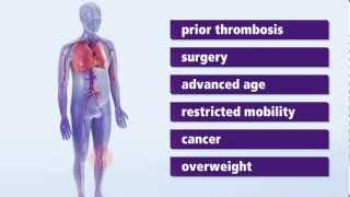 About Thrombosis Symptoms and risk factors for deep vein thrombosis DVT [upl. by Elly]