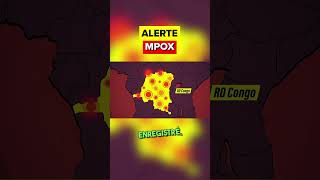 Doù Vient le MPOX   Variole du singe  Monkeypox shorts short [upl. by Letniuq]