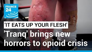 It eats up your flesh Tranq the new drug worsening Americas opioid epidemic • FRANCE 24 [upl. by Faydra]