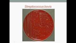 Bacteriology Streptococcus Gram Positive Cocci [upl. by Vidda322]