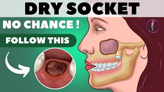 Tooth extraction aftercare I Wisdom tooth extraction  Tips for faster healing amp prevent dry socket [upl. by Yniffit276]