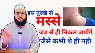 7 दिन में मस्से ख़त्म हो जाते है  Masse Khtam Kare Sirf 7 Din Me  🙂 Maulana Farman Nasim [upl. by Laise]